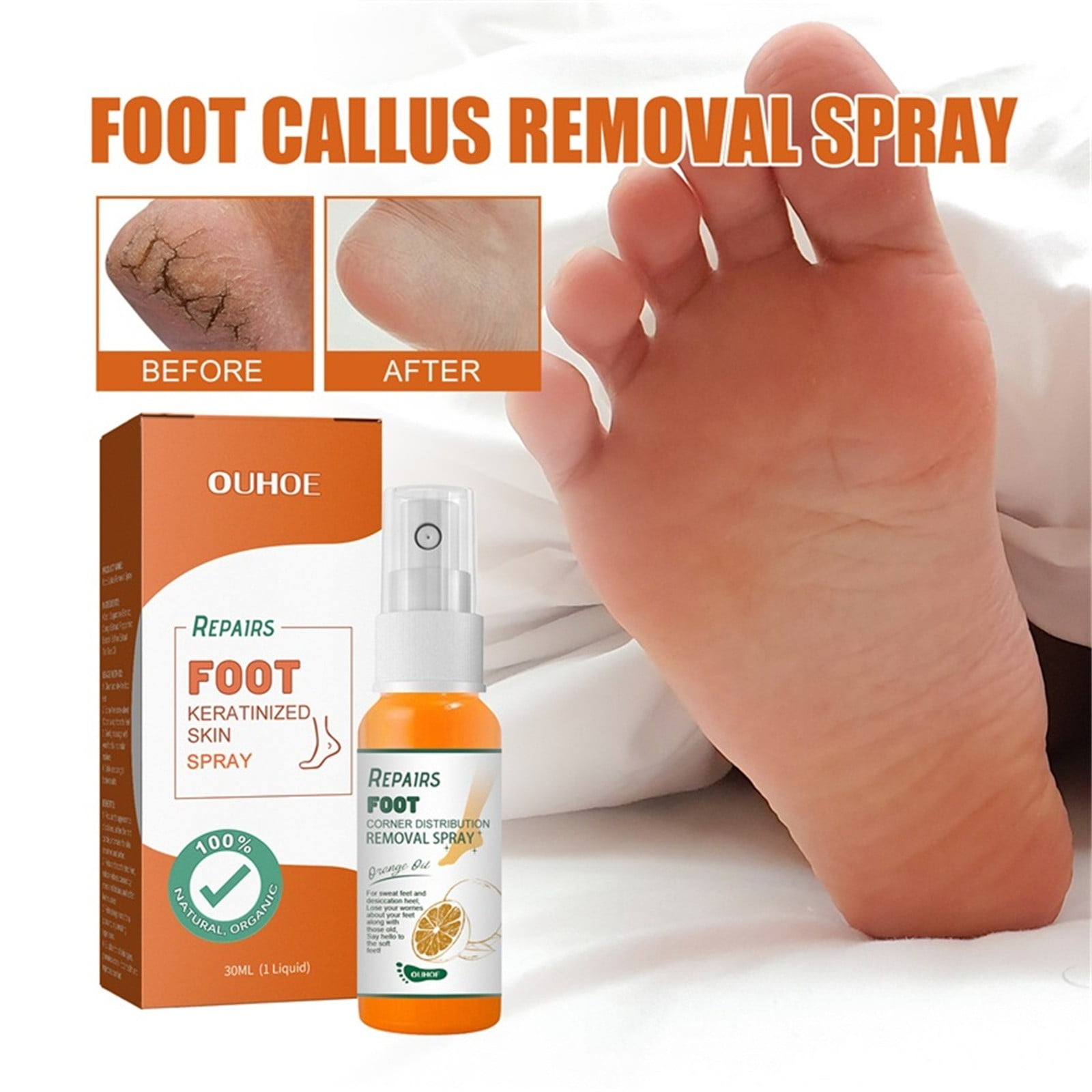 Dealovy Foot Callus Removal Spray Foot Peeling Spray,Feet Instant Foot
