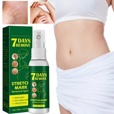 Deals of The Week Clearance! Stretch Marks Removal Spray Stretch Marks Belly Wrinkles Fat Stretch Marks Moisturizing Removal 30Ml Halloween Thanksgiving Christmas New Year Clearance Sales