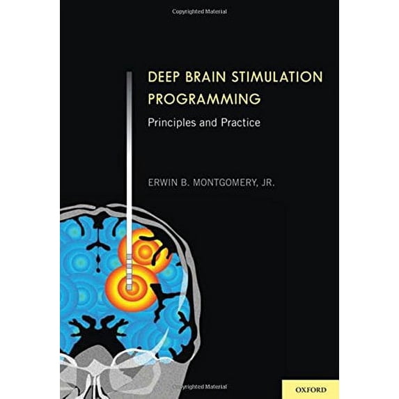Pre-Owned Deep Brain Stimulation Programming: Principles and Practice Paperback