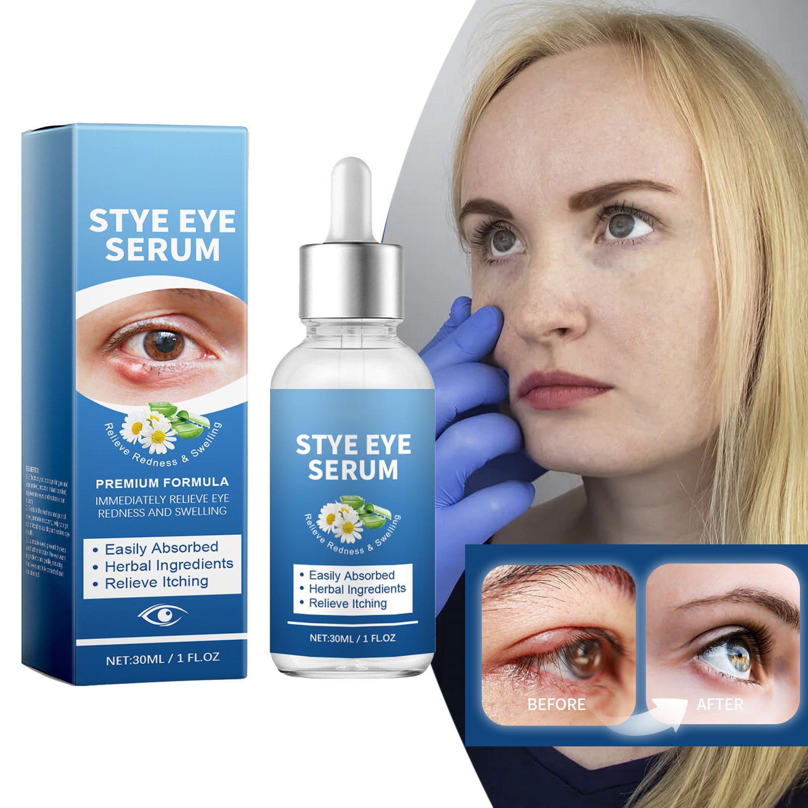 Deep Cleansing Caring For Eye Health Choose Our Eye Wash For Instant Of Eye Fatigue And Of Bright Eyes [30ML]
