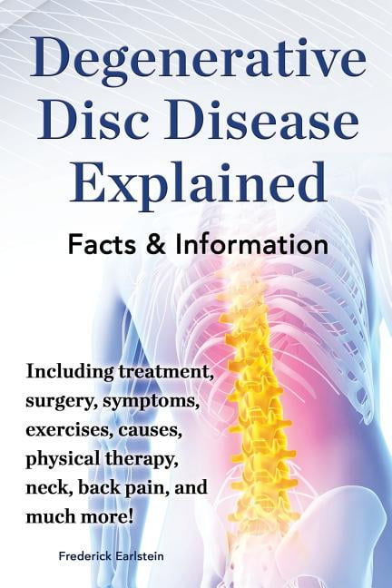 Degenerative Disc Disease Explained. Including Treatment, Surgery ...