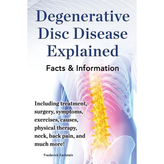 Degenerative Disc Disease Explained. Including Treatment, Surgery, Symptoms, Exercises, Causes, Physical Therapy, Neck, , (Paperback)