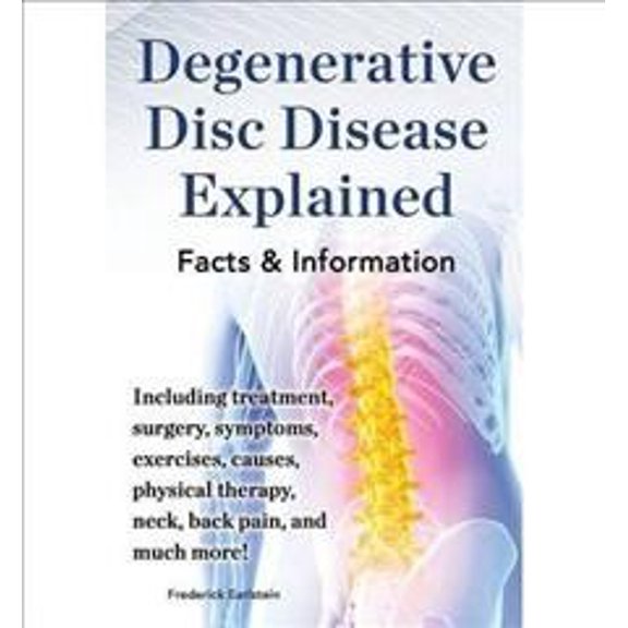 Pre-Owned Degenerative Disc Disease Explained. Including Treatment, Surgery, Symptoms, Exercises, Causes, Physical Therapy, Neck, Back, Pain, and Much More! Fac (Paperback) 0989658481 9780989658485