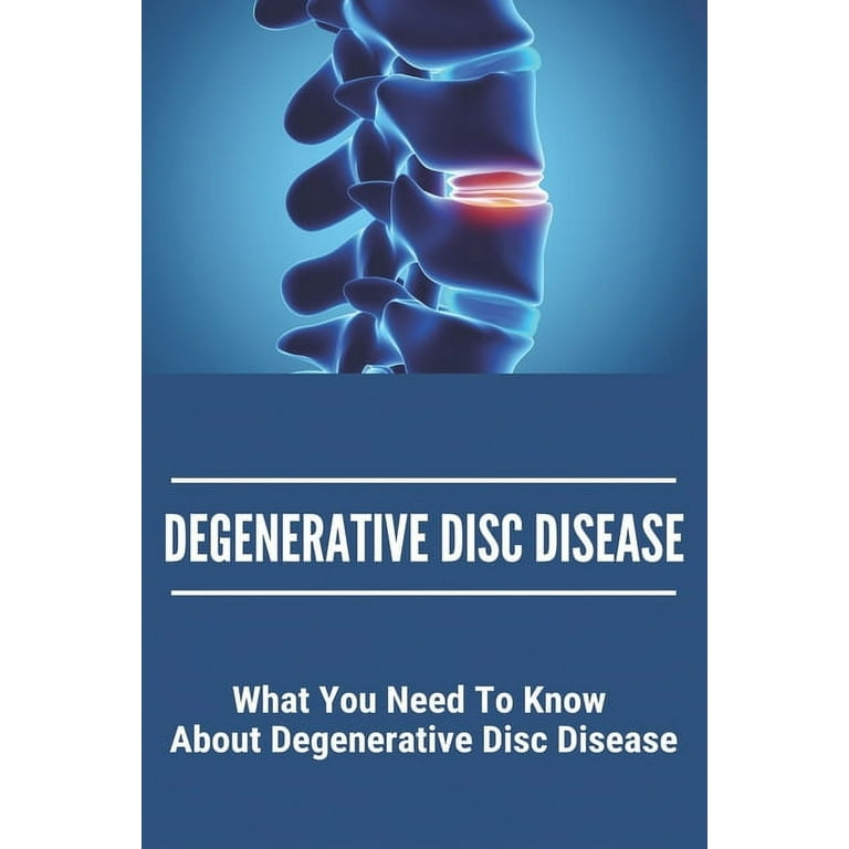 https://i5.walmartimages.com/seo/Degenerative-Disc-Disease-What-You-Need-To-Know-About-Degenerative-Disc-Disease-Degenerative-Disc-Disease-Treatment-Mayo-Clinic-Paperback-97987313263_e310d2ad-b201-4fee-8a10-386a86b9eaba.7fa3aa1a4c47293a4788944af2fa9f52.jpeg?odnHeight=768&odnWidth=768&odnBg=FFFFFF