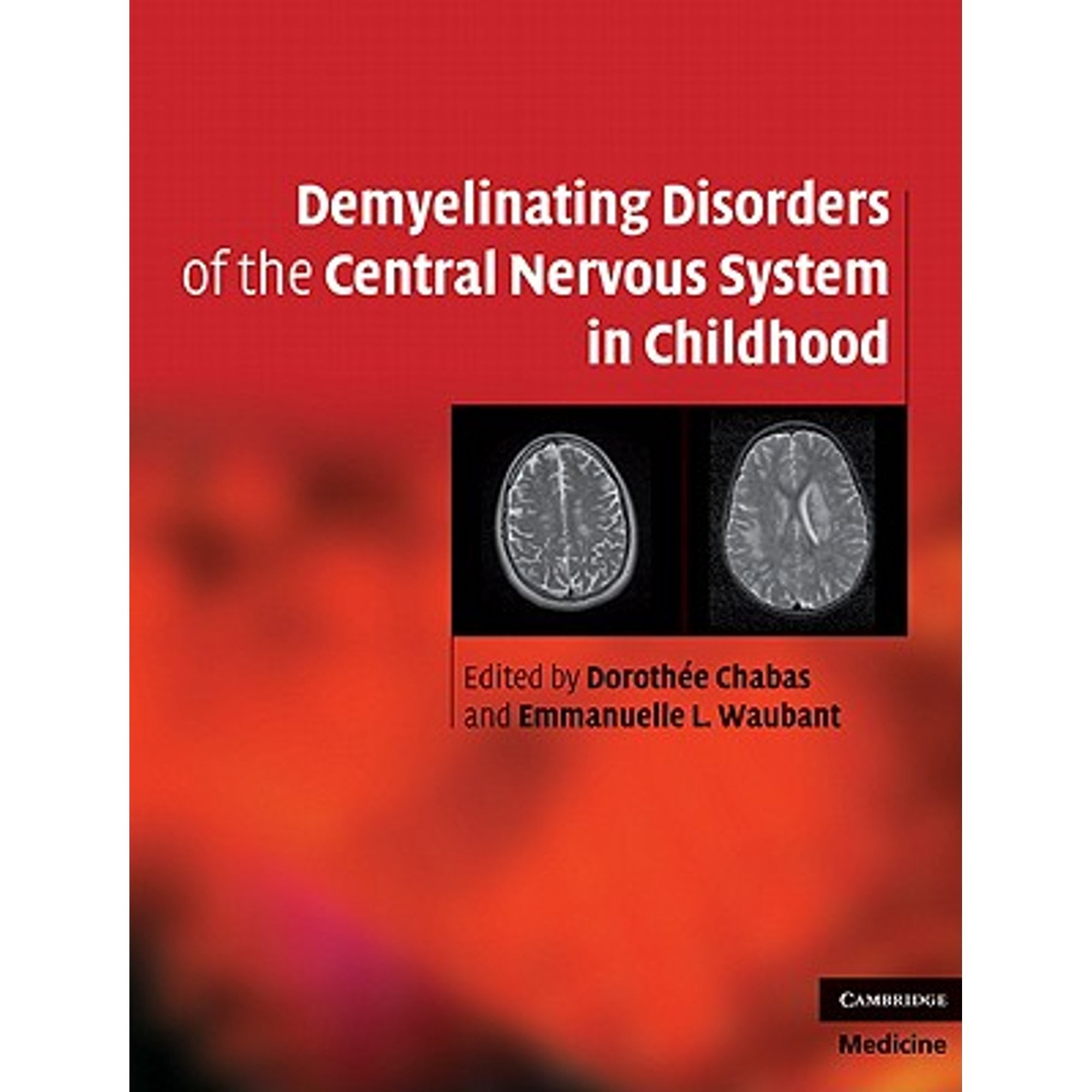 Pre-Owned Demyelinating Disorders of the Central Nervous System in ...