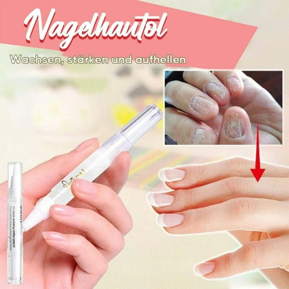 Dengmore Nail Nutritional Oil Pen Moisturizing Finger Pen Dead Skin Barb Repair Nail Care Nail Polish Nail Dotting Pens Nail Art Pens Manicure Polish Tools DIY Nail Salon At Home