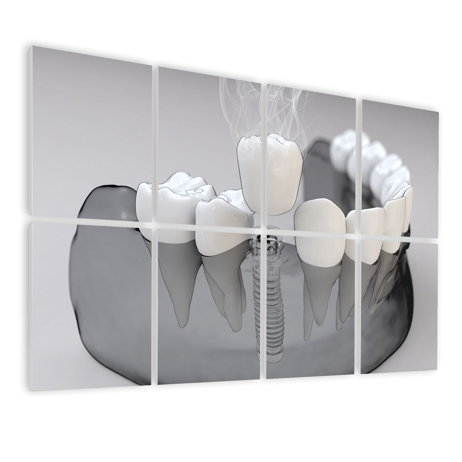 Dental 8 Pack Art Acoustic Panels Sound Absorbing 3D Anatomy implant Dental Decorative Soundproof Wall Panels Self Adhesive for Physician Hospital Office 48"x32"