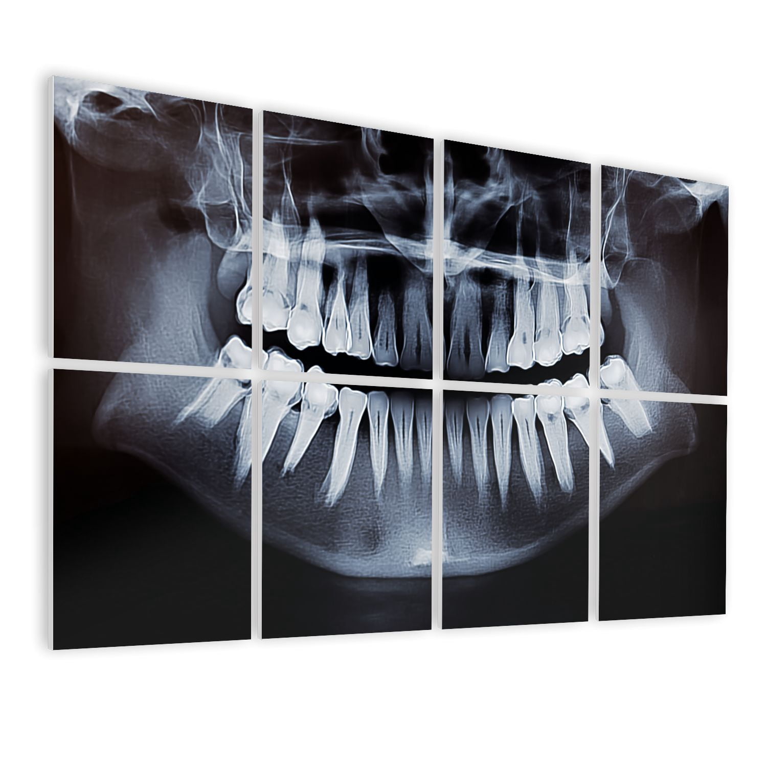 Dental 8 Pack Art Acoustic Panels Sound Absorbing Dental photography dentist Implant Anatomy Decorative Soundproof Wall Panels Self Adhesive for Physician Hospital Office 48"x32"