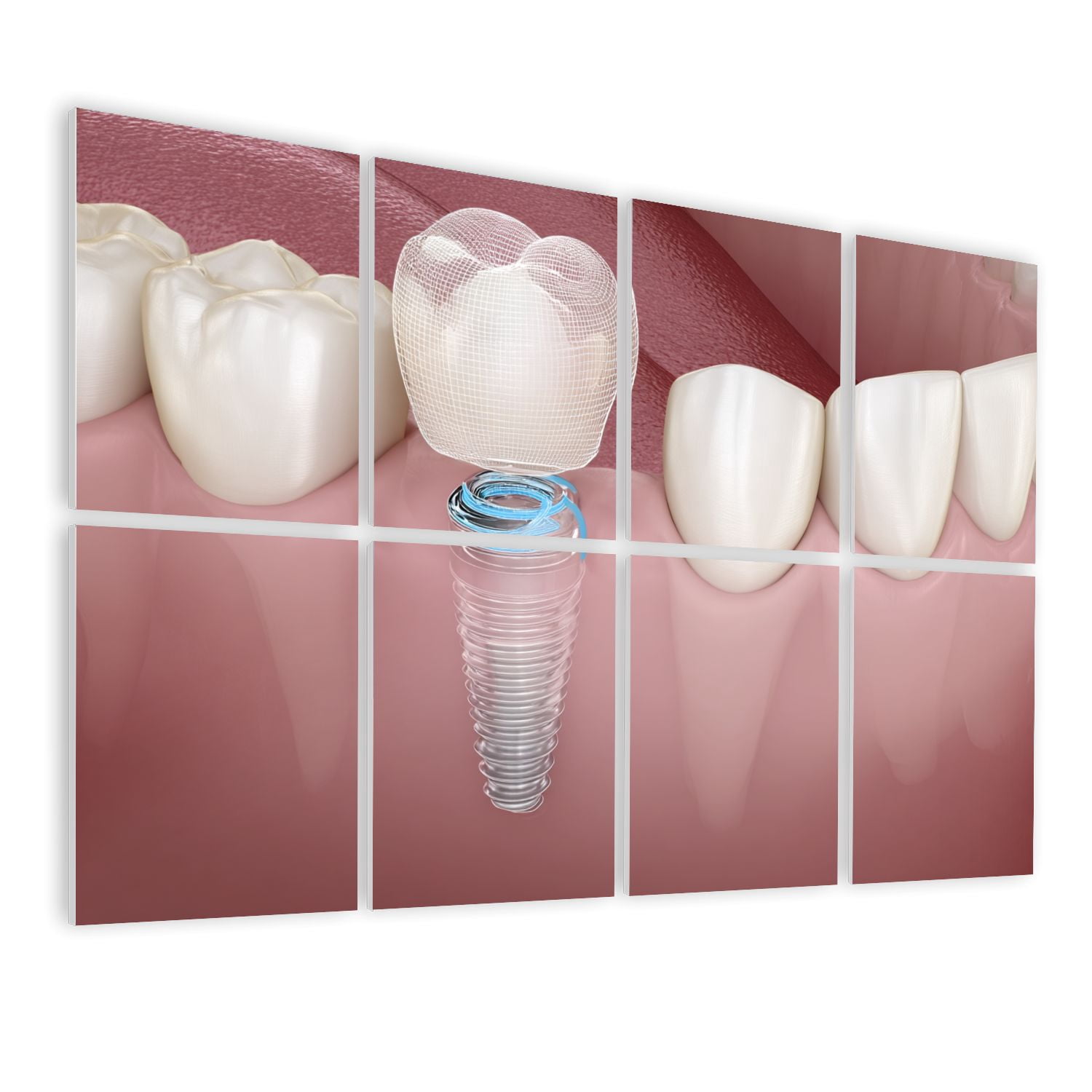 Dental 8 Pack Art Acoustic Panels Sound Absorbing Implant tooth cleaning dental Decorative Soundproof Wall Panels Self Adhesive for Physician Hospital Office 48"x32"