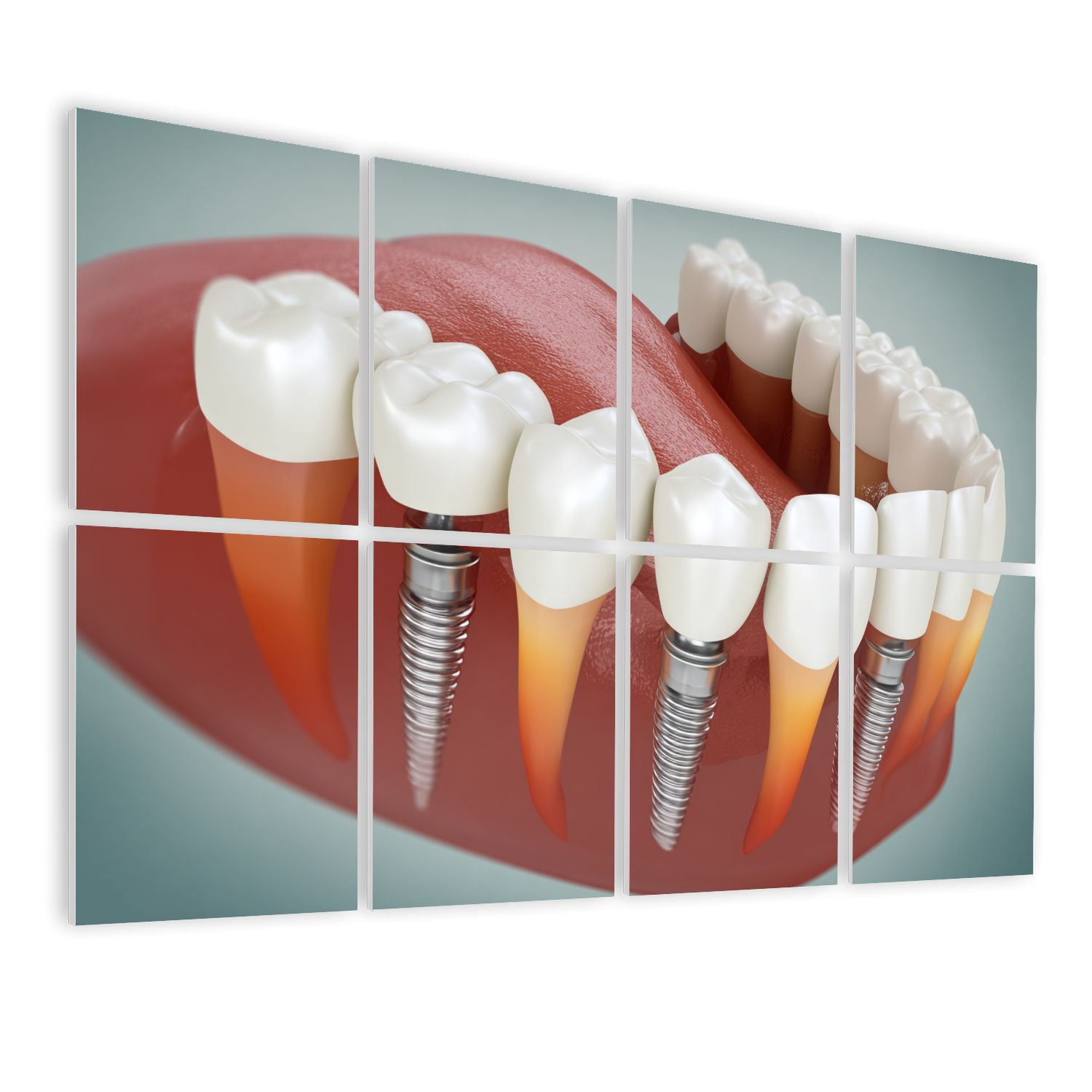 Dental 8 Pack Art Acoustic Panels Sound Absorbing Multiple Dental implant 3D Anatomy Decorative Soundproof Wall Panels Self Adhesive for Physician Hospital Office 48"x32"