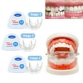 thumbnail image 1 of Dental Braces Kit, 3 Stage Teeth Straightener for Adults Orthodontic Teeth Trainer,Tooth Retainers for Adult Teen, 1 of 8