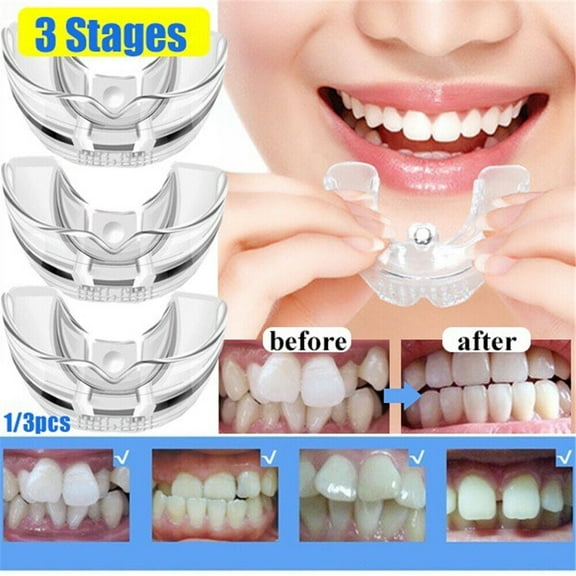 Dental Braces Tooth Retainer Straighten 1+2+3 Stage Orthodontic Teeth Corrector