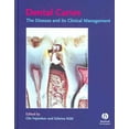 thumbnail image 1 of Pre-Owned Dental Caries: The Disease and Its Clinical Management (Hardcover) 1405107189 9781405107181, 1 of 1