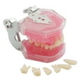 thumbnail image 1 of Dental Demonstration Tooth Extraction Model Standard Study Teaching All Removable Teeth, 1 of 6
