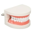 Dental Disease Caries Teeth Model Resin Simulation Teaching Prop Dental