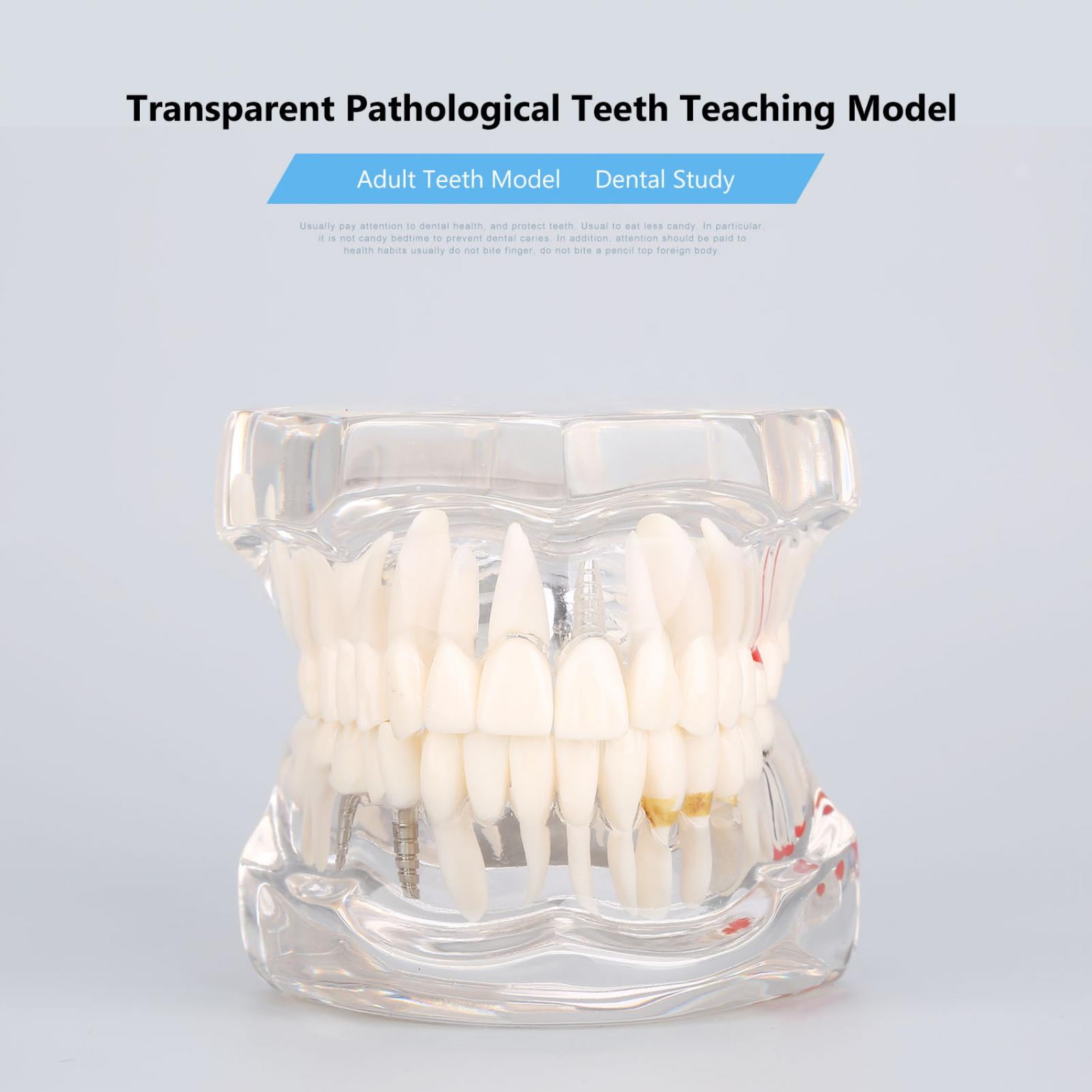 Dental Study Teaching Model Dental Impant Standard Model Removable Teeth ADULT Child TYPODONT Model Dentist Communication Model 241218 From Huo04, $38.25
