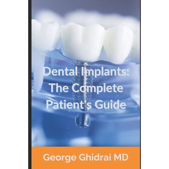 Dental Implants: The Complete Patient's Guide, (Paperback)
