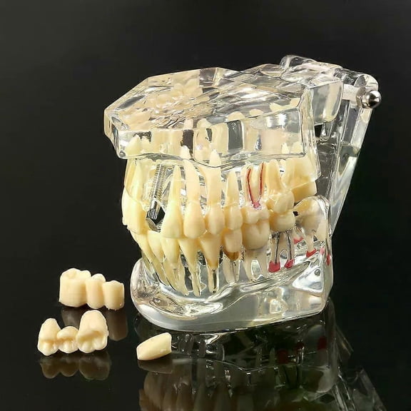 Dental Models Repairable Resin Models Of Diseased Teeth For Teaching And Research In Medicine And Dental Diseases