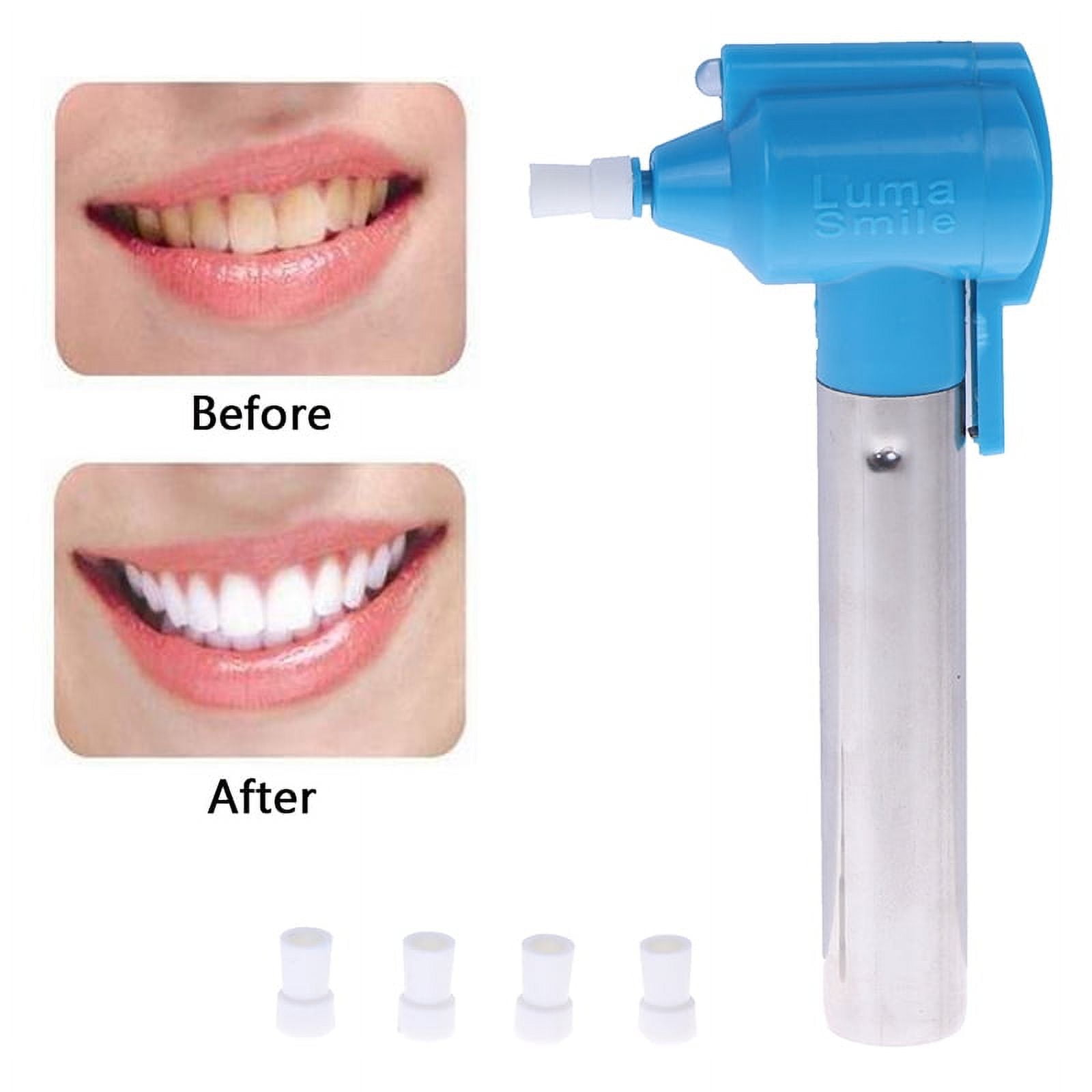 100pcs Dental Tooth Polishing Teeth Whitener Whitening Polisher Stain Remover Tool Kit