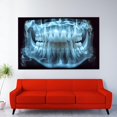 Tooth 18 Radiograph Dental X Ray Art, Modern Tooth Anatomy, Blue Radiology Poster, Dentist ...