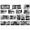 thumbnail image 1 of Dental X Rays, 1 of 1