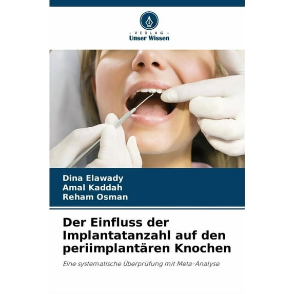 Der Einfluss der Implantatanzahl auf den periimplantären Knochen, (Paperback)