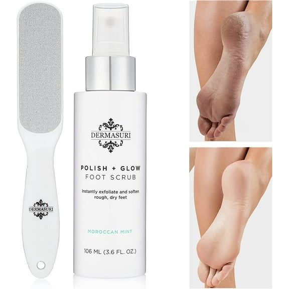 Dermasuri Callus Remover with Spray-on Formula and Foot File, Soften Cracked Heels for Dry Skin