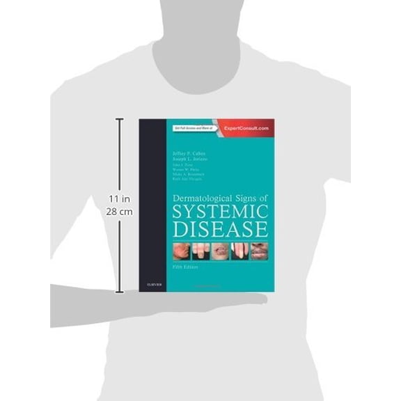 Pre-Owned Dermatological Signs of Systemic Disease, 5e: Expert Consult - Online and Print Hardcover