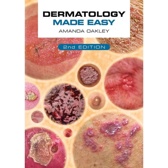 Dermatology Made Easy, Second Edition, (Paperback)