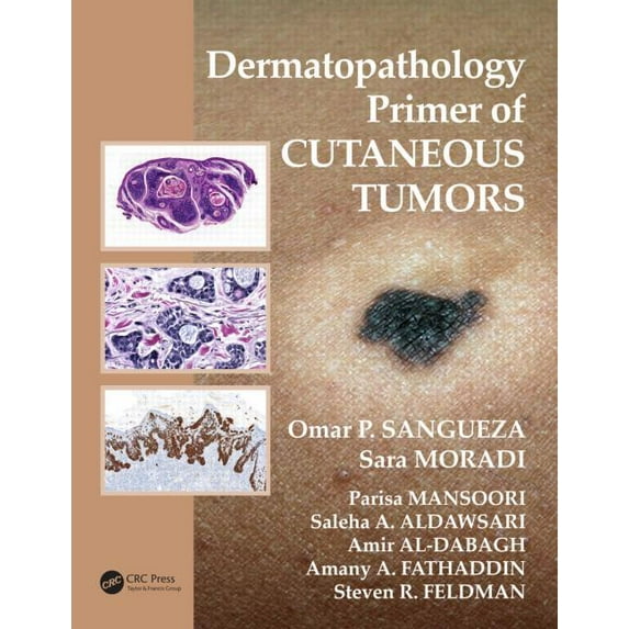 Dermatopathology Primer of Cutaneous Tumors (Paperback)