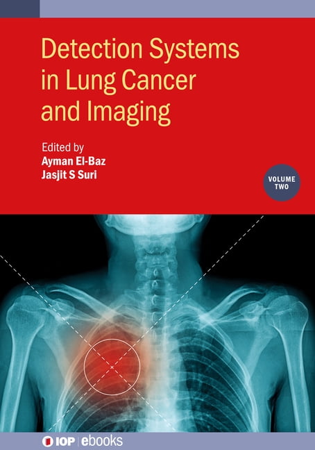 Iop eBooks Detection Systems in Lung Cancer and Imaging, Volume 2, (Paperback)