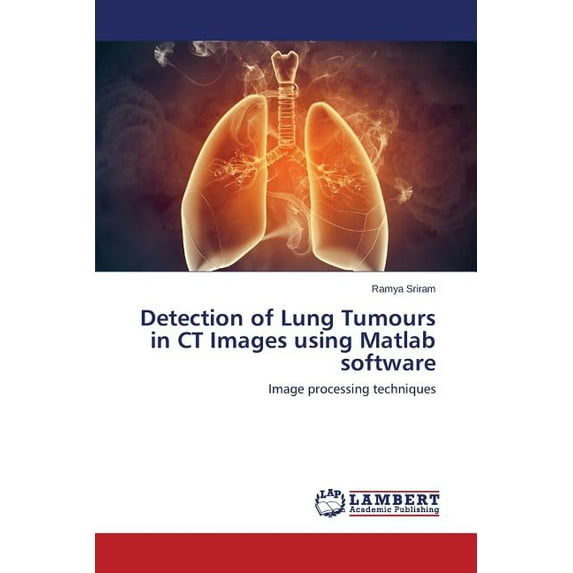 Detection of Lung Tumours in CT Images using Matlab software (Paperback)