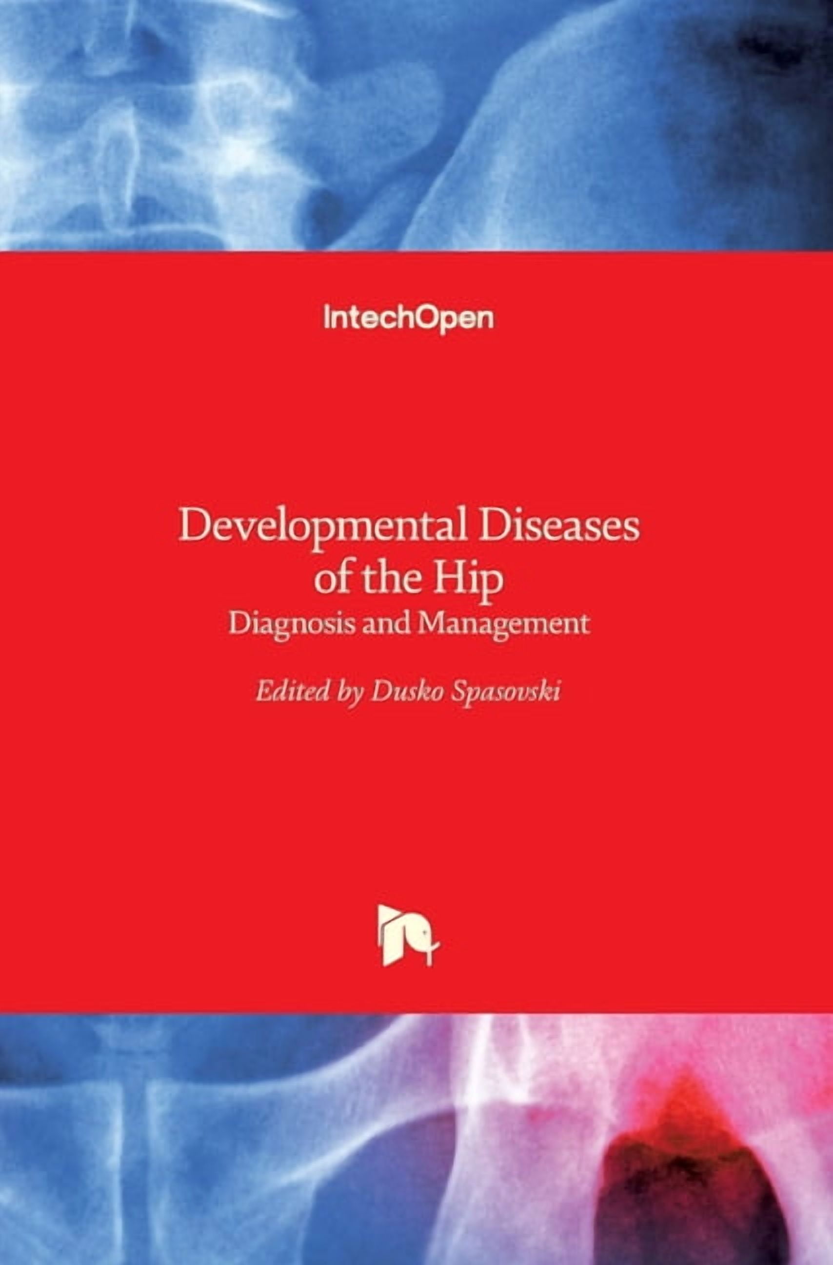 Developmental Diseases of the Hip: Diagnosis and Management (Hardcover ...