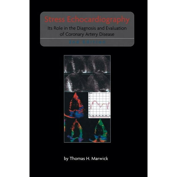 Developments in Cardiovascular Medicine Stress Echocardiography: Its Role in the Diagnosis and Evaluation of Coronary Artery Disease, Book 247, (Paperback)