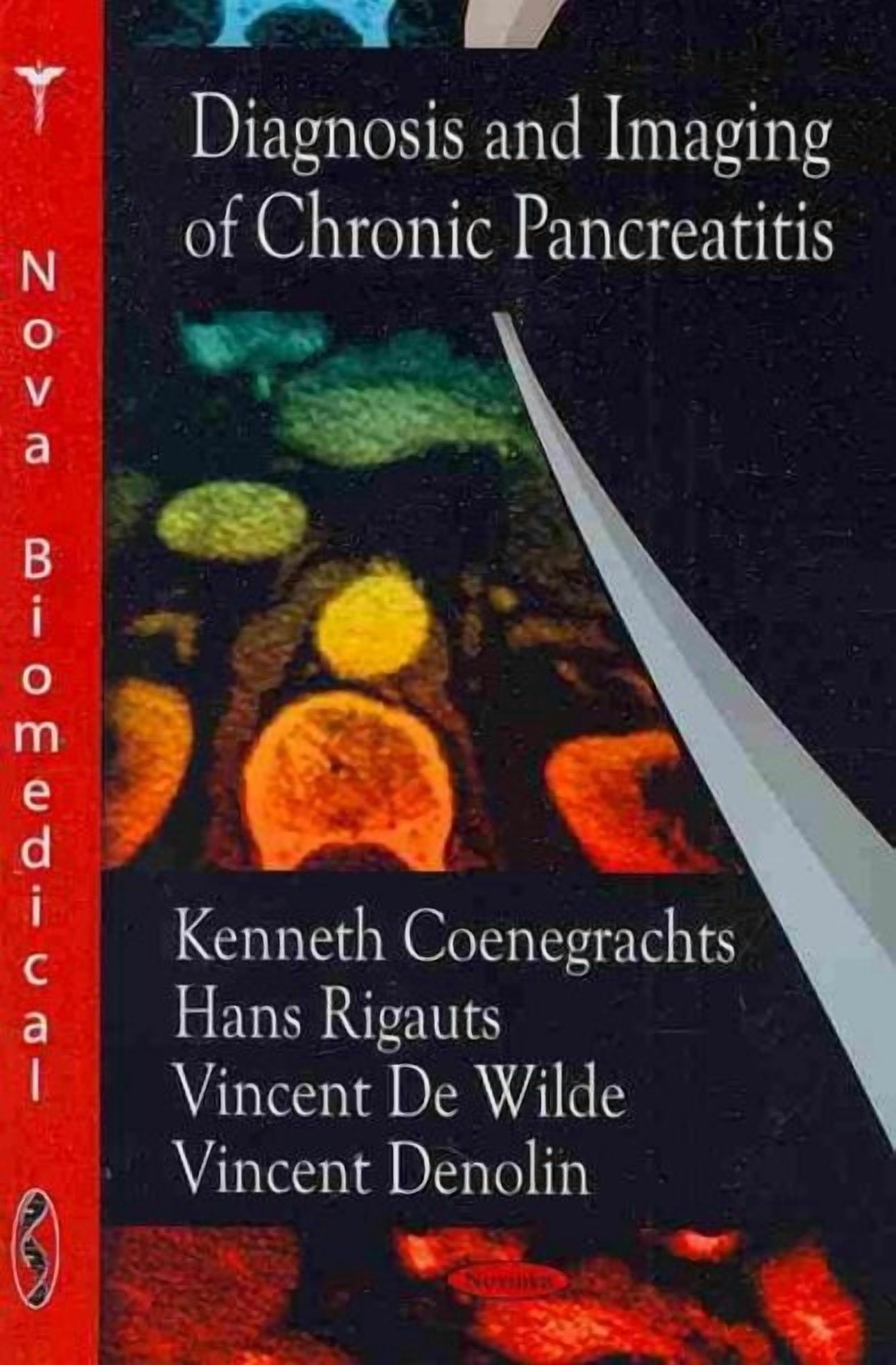 Diagnosis and Imaging of Chronic Pancreatitis - Walmart.com