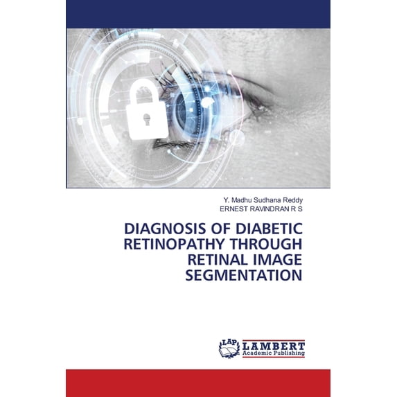 Diagnosis of Diabetic Retinopathy Through Retinal Image Segmentation, (Paperback)