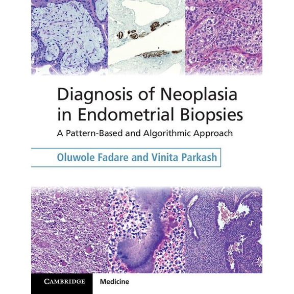 Diagnosis of Neoplasia in Endometrial Biopsies Book and Online Bundle: A Pattern-Based and Algorithmic Approach, (Paperback)