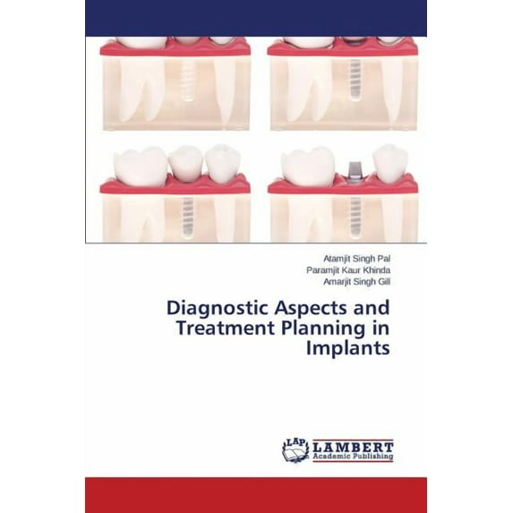 Diagnostic Aspects and Treatment Planning in Implants (Paperback)
