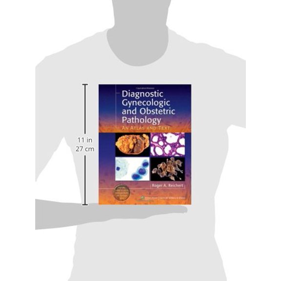 Pre-Owned Diagnostic Gynecologic and Obstetric Pathology: An Atlas and Text [Hardcover] Reichert MD PhD, Roger A.