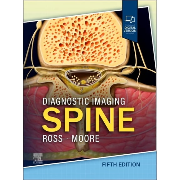 Diagnostic Imaging: Spine, (Hardcover)