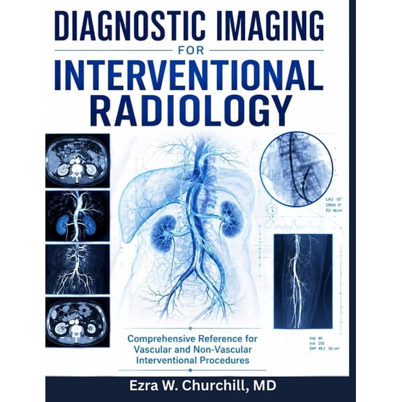 Diagnostic Imaging for Interventional Radiology: Comprehensive Reference for Vascular and Non-Vascular Interventional Pr, (Paperback)