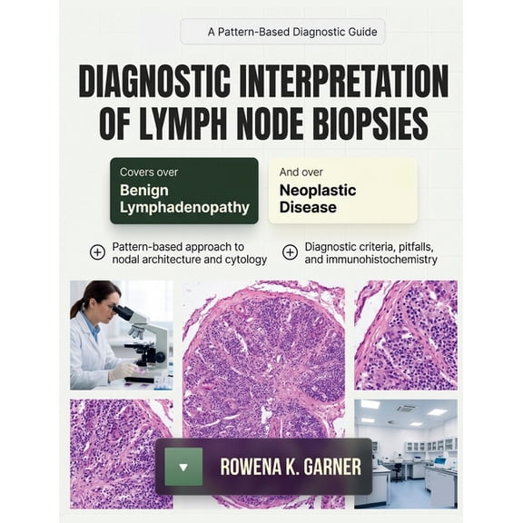 Diagnostic Interpretation of Lymph Node Biopsies: A Pattern-Based Guide to Benign and Neoplastic Lymphadenopathy for Pat, (Paperback)