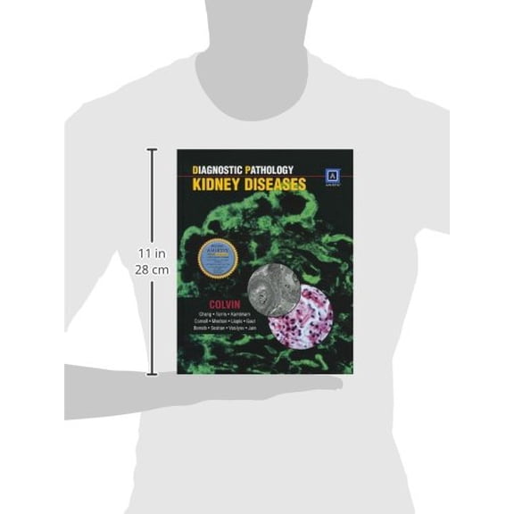 Pre-Owned Diagnostic Pathology: Kidney Diseases (Hardcover) 1931884536 9781931884532