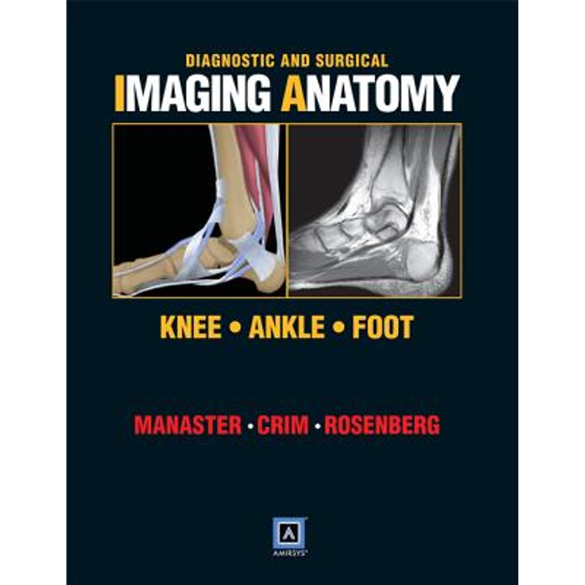 Diagnostic \u0026 Surgical Imaging Anatomy: Diagnostic and Surgical Imaging Anatomy : Knee, Ankle, Foot (Hardcover)