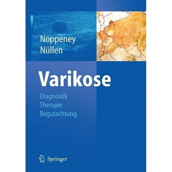 Diagnostik Und Therapie der Varikose