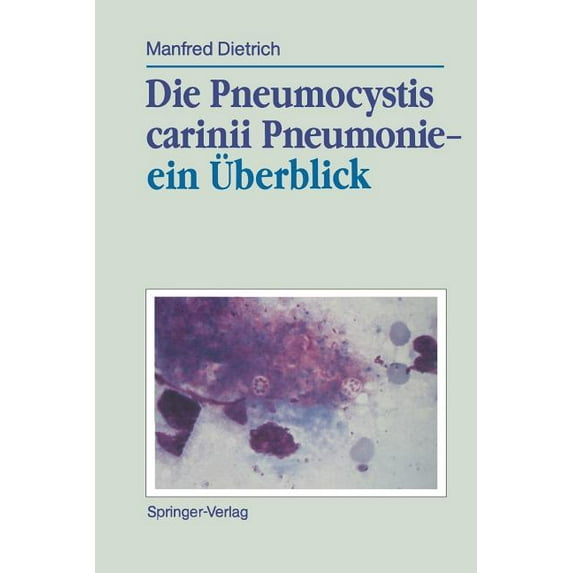 Die Pneumocystis Carinii Pneumonie-- Ein Überblick, (Paperback)