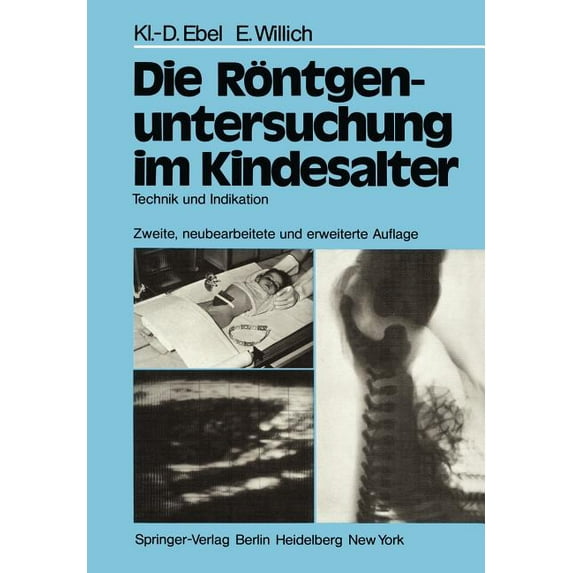 Die Röntgenuntersuchung Im Kindesalter: Technik Und Indikation, (Paperback)