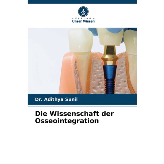 Die Wissenschaft der Osseointegration, (Paperback)