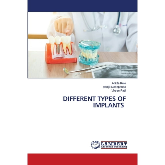 Different Types of Implants, (Paperback)