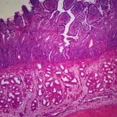 thumbnail image 1 of Digestive Tract Microscope Slide Set, 1 of 1